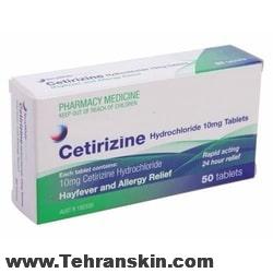 ستیریزین، بهترین دارو برای درمان واکنش های آلرژیک و کهیر cetirizine - ستیریزین، بهترین دارو برای درمان واکنش های آلرژیک و کهیر