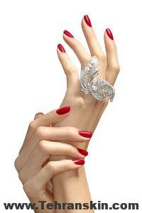 تزریق چربی بهترین روش جوانسازی پوست دست