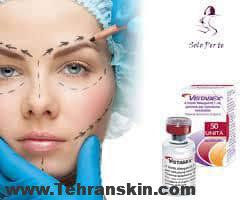 چند خبر جدید از بهترین مرکز بوتاکس تهران که احتمالا به گوشتون نخورده! disport and botox - چند خبر جدید از بهترین مرکز بوتاکس تهران که احتمالا به گوشتون نخورده!