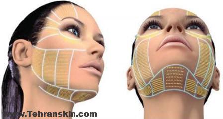 بهترین روش برای جوانسازی پوست چیست | در مرکز لیزر و زیبایی برکه جوان شوید!