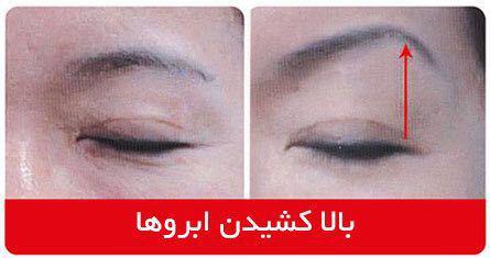 بهترین مرکز هایفوتراپی سپهر