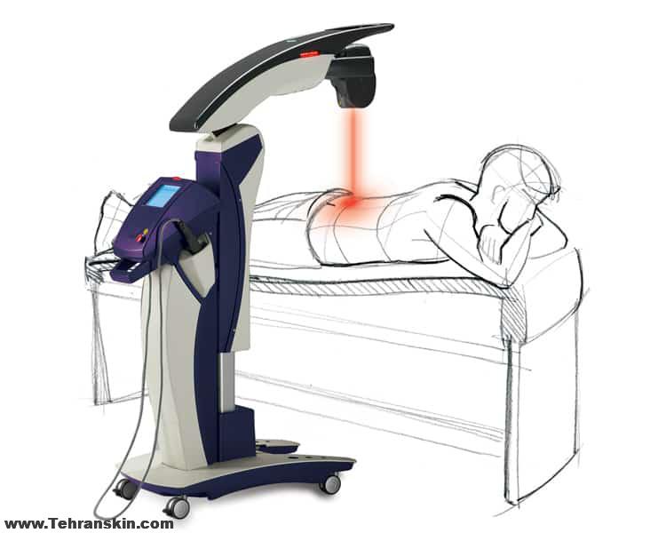 بهترین مرکز لیزر درمانی در اهواز