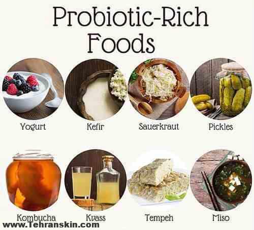 پروبیوتیک ها