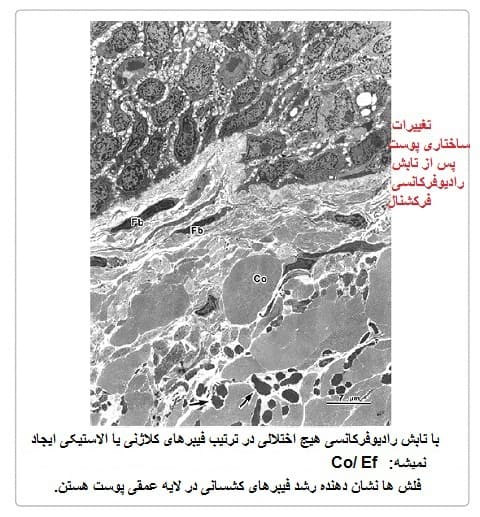 تابش امواج رادیوفرکانسی به پوست