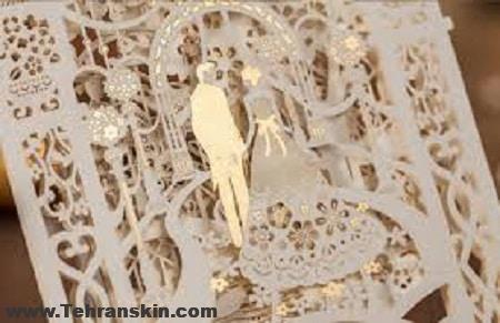 لیزر آپوجی پاسداران قبل از عروسی (لیزر موهای زائد)