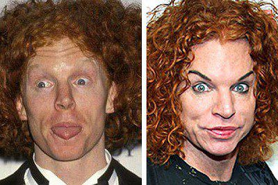 عمل جراحی بینی بازیگران قبل و بعد