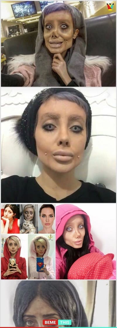 عمل بینی و جراحی بد بازیگران