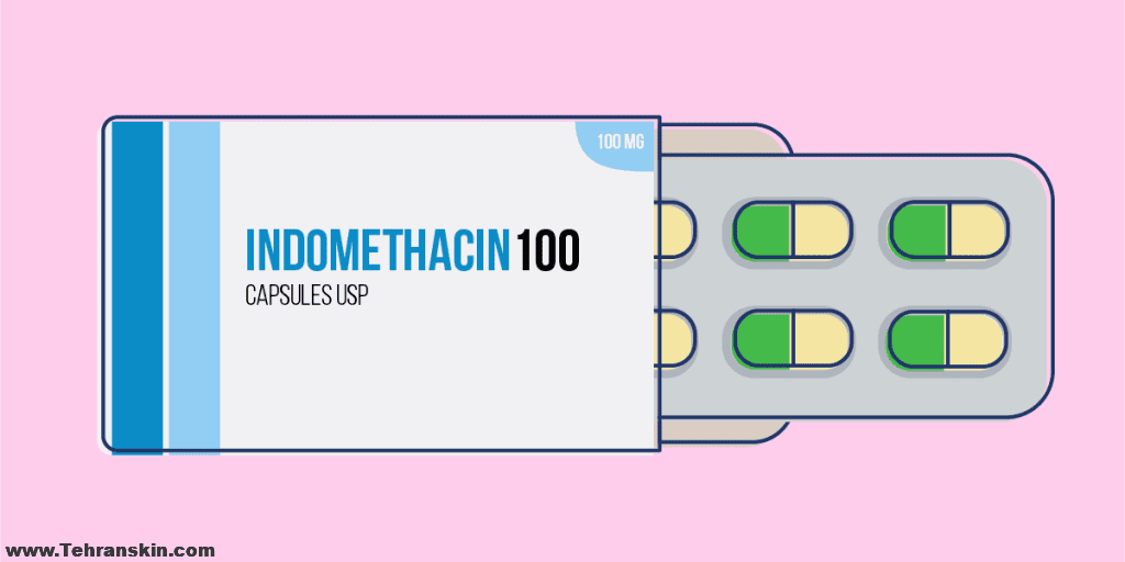 قرص ایندومتاسین