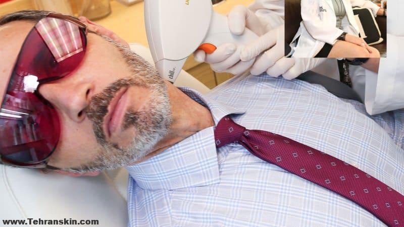 لیزر موهای زائد آقایان و ورزشکاران