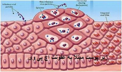 عفونت پوست مبتلا به ویروس HPV