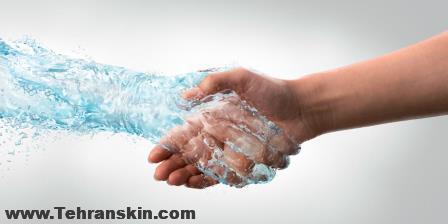 عرق کردن بیش از حد