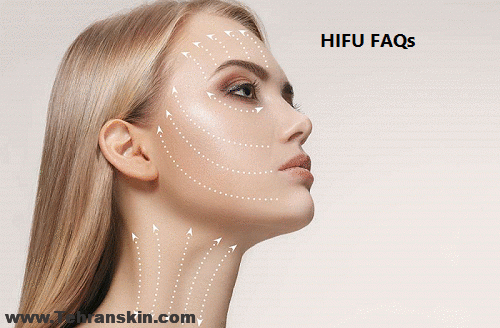 سوالات رایج هایفوتراپی