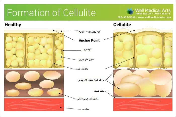 ساختار بافت سلولیت