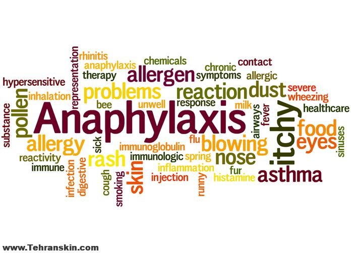 انافیلاکسی