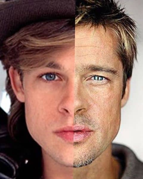 برد پیت و جوانسازی پوست با لیزر فرکشنال