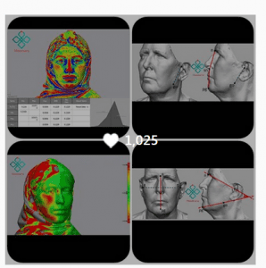 زیبایی اندام در کلینیک هومارا: نماینده انحصاری برند اکتس مدیکال