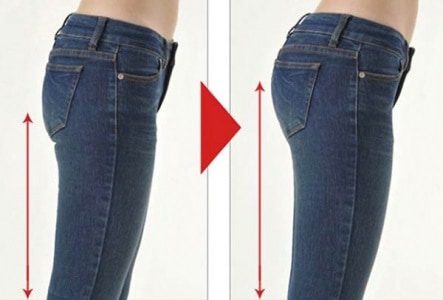 لیفت باسن به صورت غیرتهاجمی در کلینیک هومارا