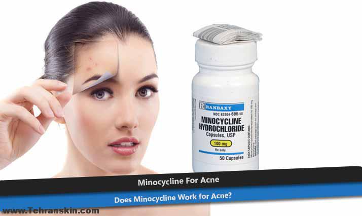 مینوکسیلین 50