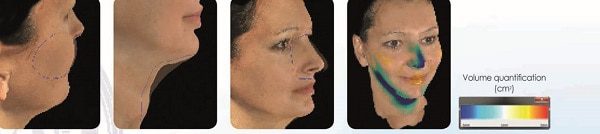 اسکنر سه بعدی آنالیز چهره کلینیک هومارا