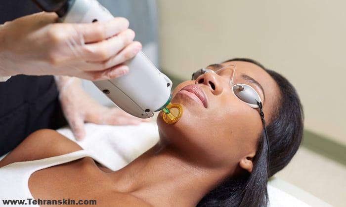 عوارض جانبی موهای زائد