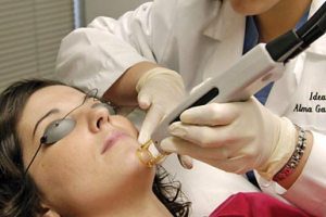 رفع مویرگ های صورت با لیزر الکساندریت