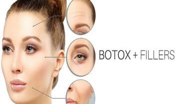 تزریق فیلر یا بوتاکس ؟ کدامیک بهتر است؟