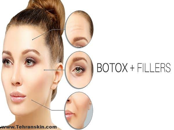 تزریق فیلر یا بوتاکس ؟ کدامیک بهتر است؟