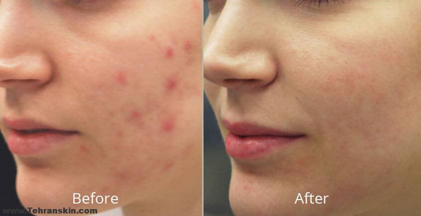 بازسازی و جوان سازی پوست در بهترین مرکز لیزر