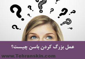 جراحی بزرگ کردن باسن با پروتز |