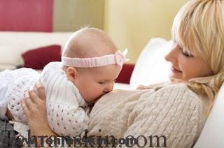 ليزر كردن موهاي زائد در دوران شيردهي