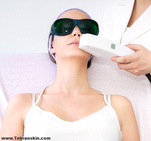 در فاصله بین جلسات لیزر موهای زائد چطوری از پوست خود مراقبت کنیم