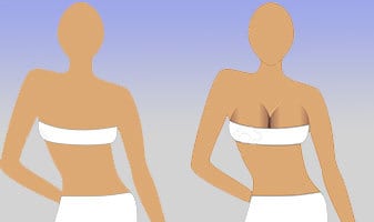 چطوری با پروتز سینه صاحب سینه های خوش فرم و برجسته بشویم؟