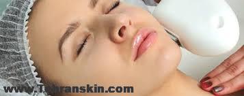 لیزر موهای صورت