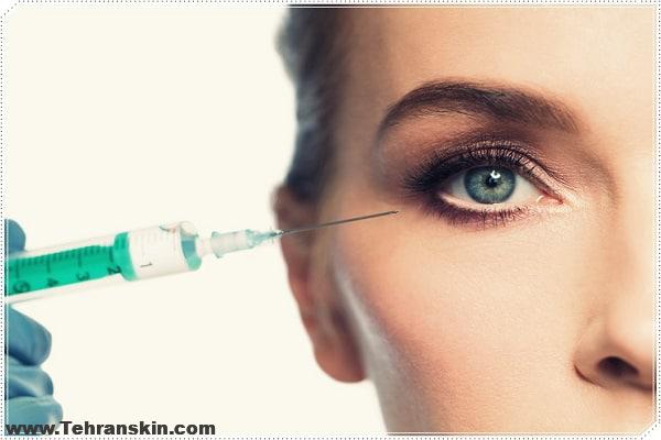 کربوکسی درمانی به از بین بردن حلقه های تیره زیر چشم ها کمک می کند