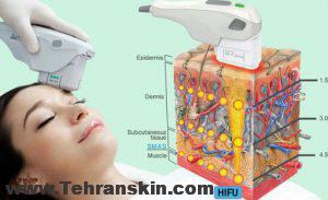 بهترین روش برای جوانسازی پوست چیست | در مرکز لیزر و زیبایی برکه جوان شوید!