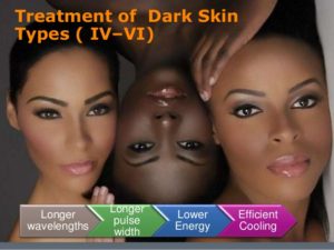 حذف موهای زائد برای پوست های تیره در مرکز لیزر برکه