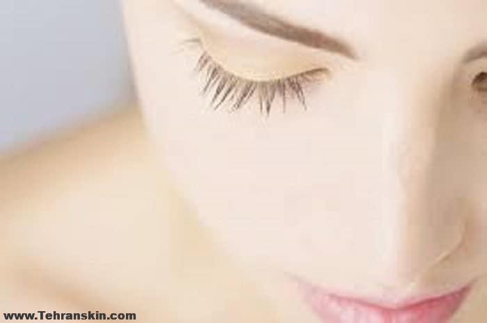 پاکسازی جوش لک و آکنه در مرکز میکرو هیدرودرمی