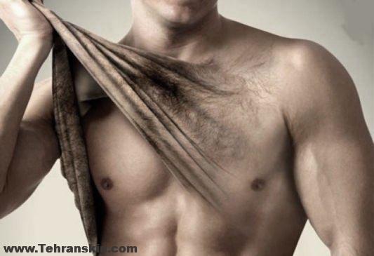 لیزر موهای زائد آقایان