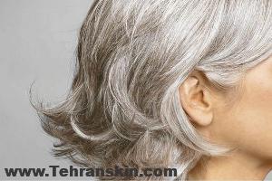 لیزر موهای زائد صورت برای زنان بالای 60 سال