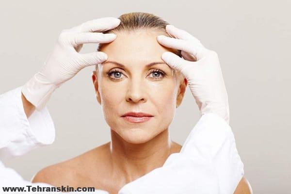 بلفاروپلاستی پلک پایین