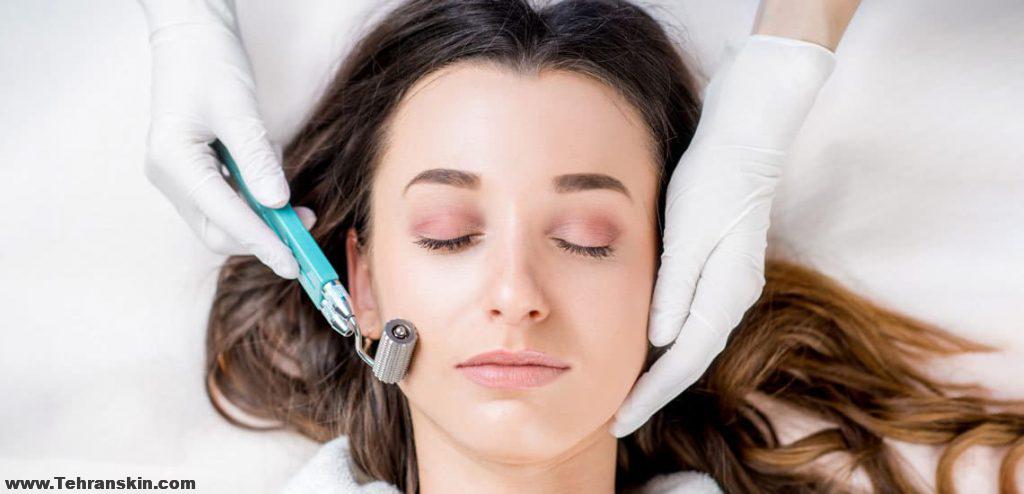 میکرونیدلینگ بهتر است یا لیزر