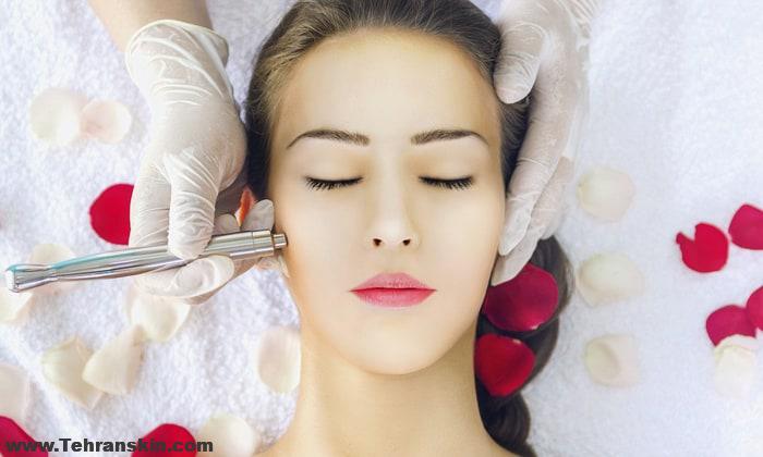 هزینه هر جلسه میکرودرم