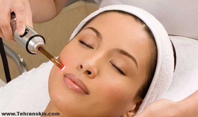 تفاوت میکرونیدلینگ و rf