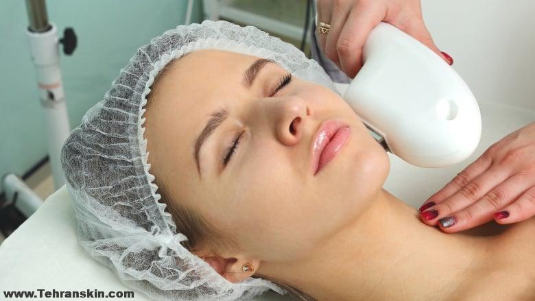 بند انداختن صورت بعد از لیزر