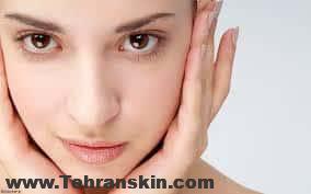 رفع موهای زائد