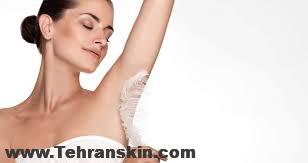 بهترین مرکز لیزر موهای زائد