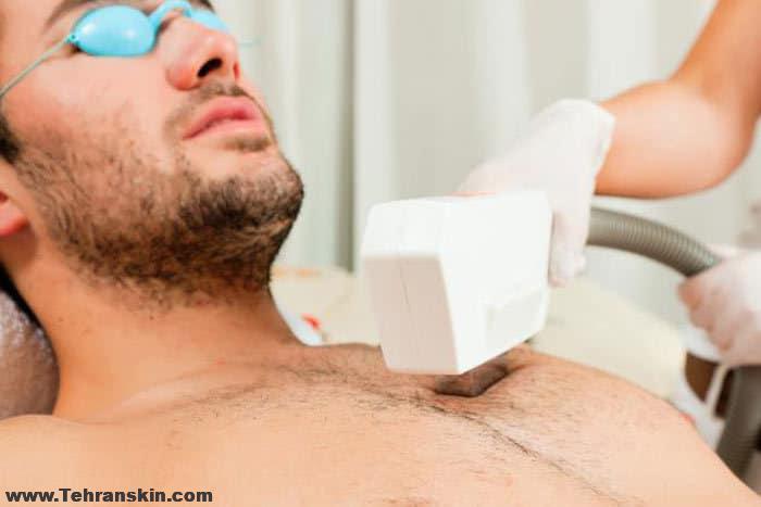 قبل از اولین جلسه لیزر موهای زائد چه کارهایی باید انجام دهید | بهترین مرکز لیزر موهای زائد آقایان