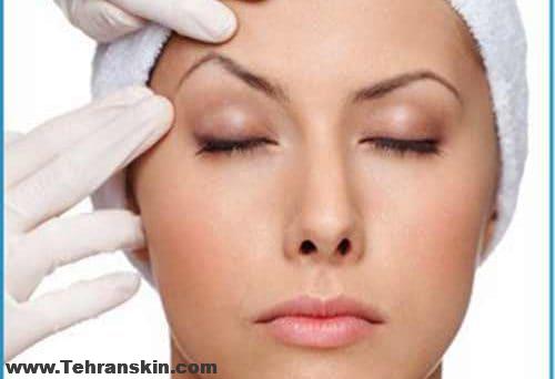 بهترین جراح پلک در تهران