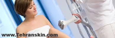 برگشت موهای زائد بعد از لیزر