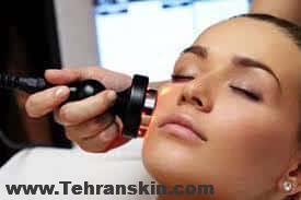 عوارض لیزر صورت